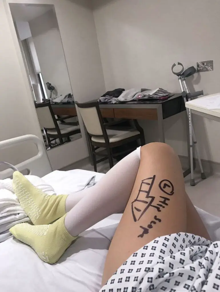 black marker pen on left thigh, marking the correct leg for hip surgery