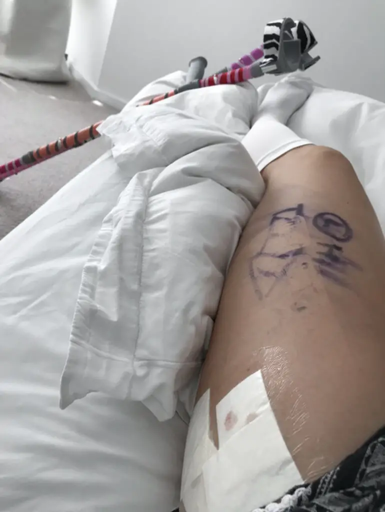 left leg with wound dressing, whilst in bed after hip surgery