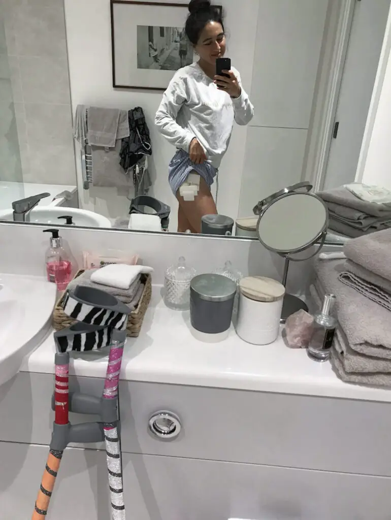 bathroom mirror selfie of Zoe showing her post op wound dressings